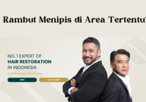 Rambut Menipis