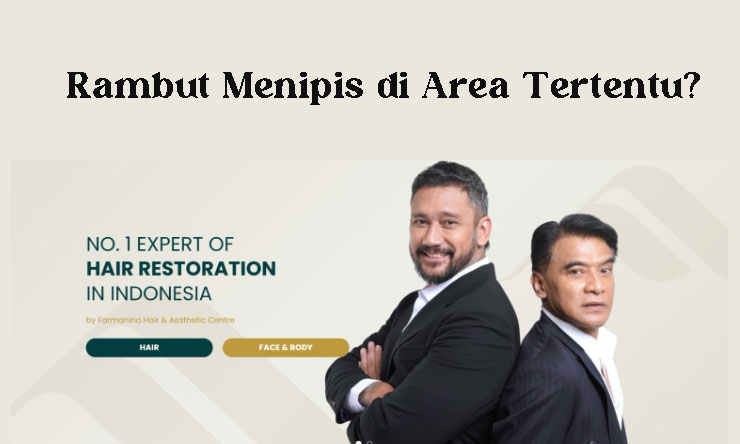 Rambut Menipis